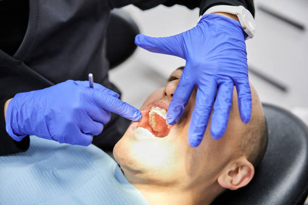 Best Emergency Dentist for Lost Fillings or Crowns in Lopezville, TX
